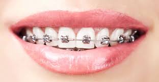 comprehensive orthodontic treatment